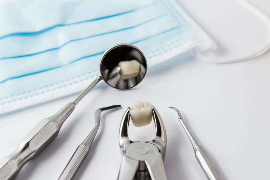 tooth extraction from Dr. Mark Gutt - Periodontist in Miami Beach and Key West